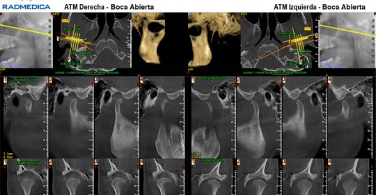 CBCT ATM